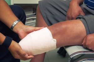 Beaumont Attorneys for Amputation Injuries from Car Accident Attorneys